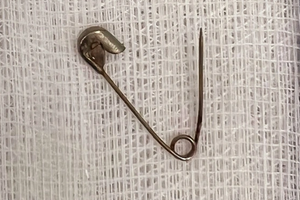 Cha mẹ gài kim băng để con ăn ngon ngủ yên, ai ngờ bé gái nuốt luôn vào bụng