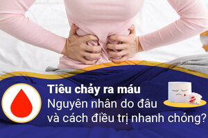 Tiêu chảy ra máu: Nguyên nhân do đâu và cách điều trị nhanh chóng