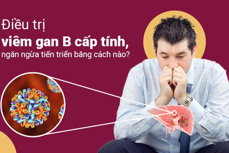 Điều trị viêm gan B cấp tính, ngăn ngừa tiến triển bằng cách nào?