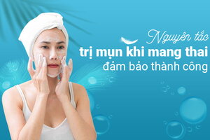Nguyên tắc trị mụn khi mang thai đảm bảo thành công