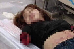 Người chồng dùng dao chém đứt lìa 2 cánh tay vợ ở Đồng Nai khai gì?