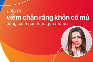 Điều trị viêm chân răng khôn có mủ bằng cách nào hiệu quả nhanh?