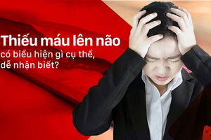 Thiếu máu lên não có biểu hiện gì cụ thể, dễ nhận biết?