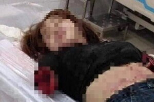 Khởi tố, bắt tạm giam người chồng chém lìa cánh tay vợ ở Đồng Nai
