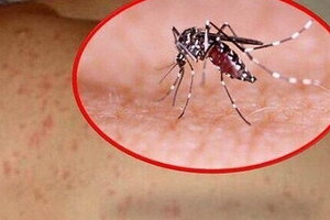 Ca sốt xuất huyết tại Hà Nội tăng cao, chuyên gia lưu ý nguy cơ biến chứng