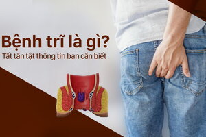 Bệnh trĩ là gì? Tất tần tật thông tin bạn cần biết