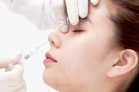 Tiêm filler nâng mũi tại spa, cô gái 27 tuổi bị mù mắt phải