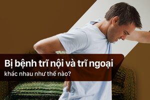 Bị bệnh trĩ nội và trĩ ngoại khác nhau như thế nào?