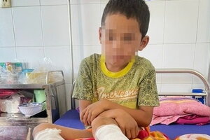 Quảng Bình: Một cháu bé bị bỏng độ 3 vì bố ruột dùng xăng và rơm đốt chân