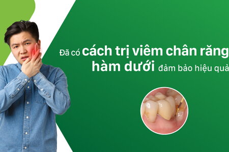 Đã có cách trị viêm chân răng hàm dưới đảm bảo hiệu quả