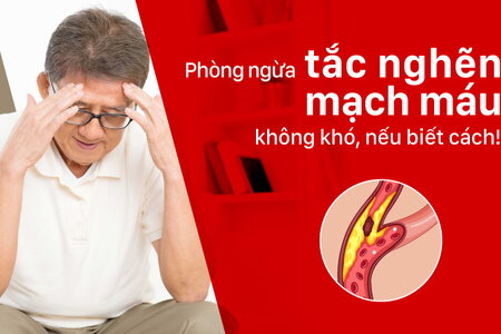 Phòng ngừa tắc nghẽn mạch máu không khó, nếu biết cách!