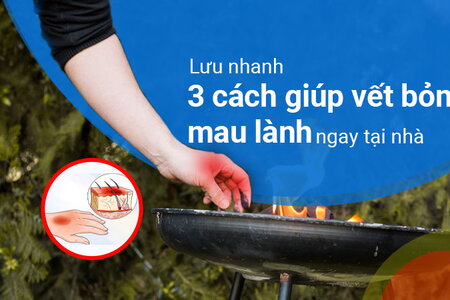 Lưu nhanh 3 cách giúp vết bỏng mau lành ngay tại nhà