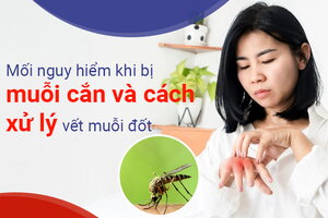 Mối nguy hiểm khi bị muỗi cắn và cách xử lý vết muỗi đốt