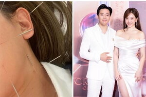 Hari Won khoe kết quả sau 3 tháng trị liệt nửa mặt và tiết lộ sự thật chuyện ly hôn Trấn Thành