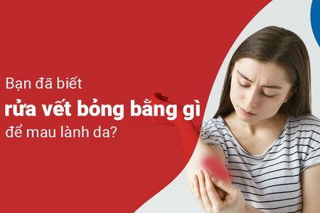 Bạn đã biết rửa vết bỏng bằng gì để mau lành da và không nhiễm trùng?