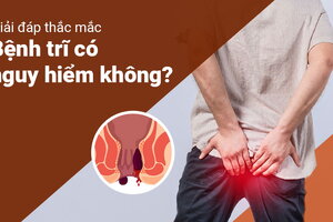 Giải đáp thắc mắc: “Bệnh trĩ có nguy hiểm không?” 