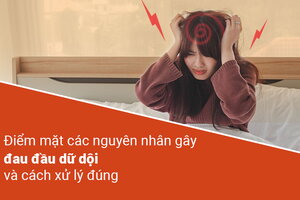 Điểm mặt các nguyên nhân gây đau đầu dữ dội và cách xử lý đúng