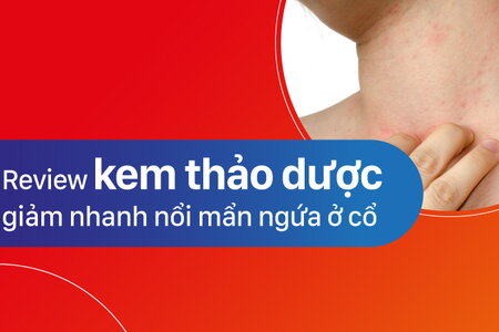 Review kem thảo dược giảm nhanh nổi mẩn ngứa ở cổ