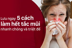 Lưu ngay 5 cách làm hết tắc mũi nhanh chóng và triệt để