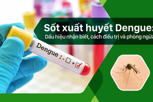 Sốt xuất huyết Dengue: Dấu hiệu nhận biết, điều trị và phòng ngừa
