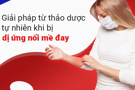 Giải pháp từ thảo dược tự nhiên khi bị dị ứng nổi mề đay