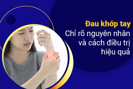 Đau khớp tay: Chỉ rõ nguyên nhân và cách điều trị hiệu quả