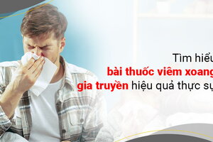 Tìm hiểu bài thuốc viêm xoang gia truyền hiệu quả thực sự