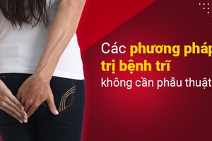 Các phương pháp trị bệnh trĩ không cần phẫu thuật