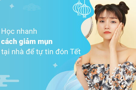 Học nhanh cách giảm mụn tại nhà để tự tin đón Tết