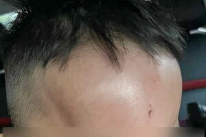 Làm rõ việc phụ huynh tố con bị bạo hành tại trường mầm non ở Đà Nẵng