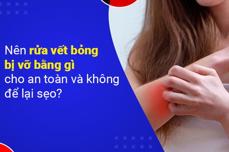 Nên rửa vết bỏng bị vỡ bằng gì cho an toàn và không để lại sẹo?