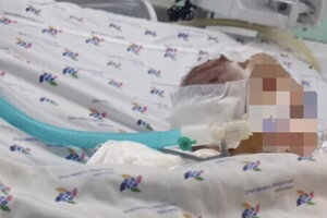TP HCM: Bé gái 6 tháng tuổi phù não nguy kịch, nghi bị bạo hành