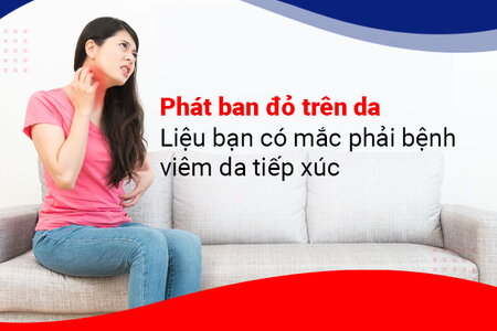 Phát ban đỏ trên da – Liệu bạn có mắc phải bệnh viêm da tiếp xúc?