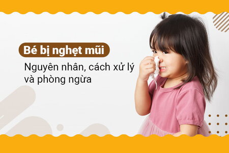 Bé bị nghẹt mũi: Nguyên nhân, cách xử lý và phòng ngừa