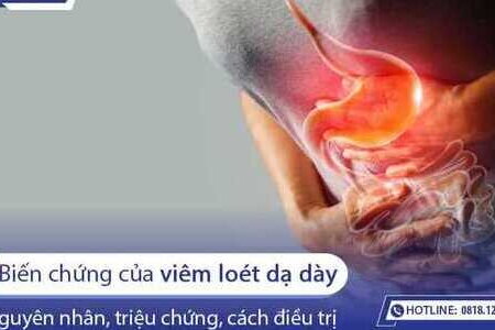 4 biến chứng của bệnh viêm loét dạ dày, tá tràng phổ biến nhất