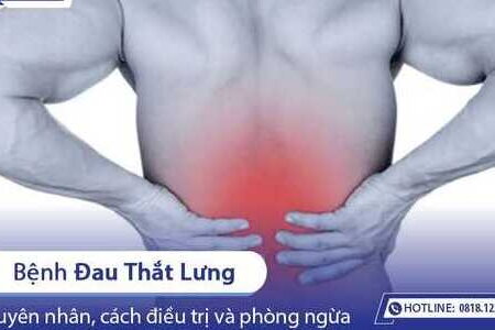 Đau thắt lưng - Nguyên nhân, cách điều trị và phòng ngừa