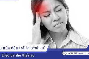 Đau nửa đầu trái là bị bệnh gì?