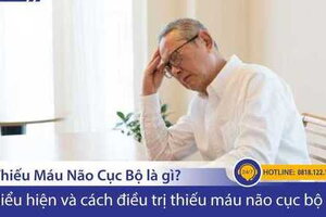 Thiếu máu não cục bộ là gì? Biểu hiện & điều trị thiếu máu não cục bộ