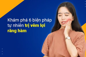 Khám phá 6 biện pháp tự nhiên trị viêm lợi răng hàm