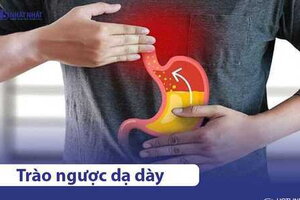 Trào ngược dạ dày: Nguyên nhân, Triệu chứng & Cách điều trị