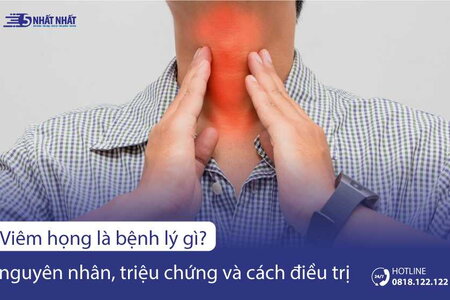 Viêm họng là bệnh gì? Nguyên nhân, triệu chứng và biện pháp điều trị