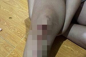 Truy tìm đối tượng nổ súng gây thương tích cho 2 chị em ở Đồng Nai