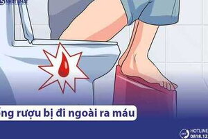 Uống rượu bia bị đi ngoài ra máu là do đâu? Có nguy hiểm không?