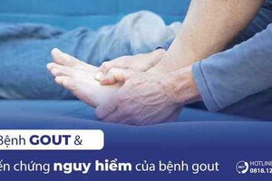 Bệnh Gout và những biến chứng nguy hiểm của bệnh Gout