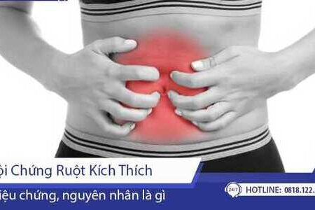 Hội chứng ruột kích thích là gì? Nguyên nhân và cách điều trị