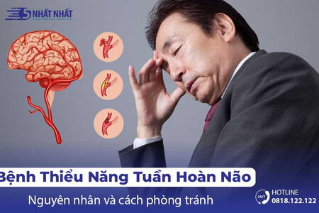 Đừng thờ ơ với bệnh thiểu năng tuần hoàn não