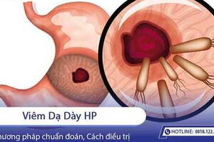 Viêm dạ dày HP là gì? Có nguy hiểm không?