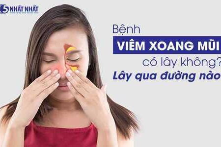 Bệnh viêm xoang mũi có lây không?