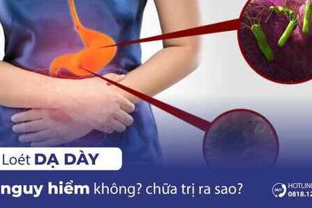 Loét dạ dày có nguy hiểm không? Chữa trị loét dạ dày như thế nào?