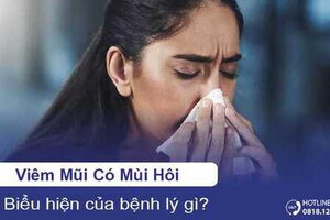 Viêm mũi có mùi hôi là biểu hiện của bệnh lý gì?